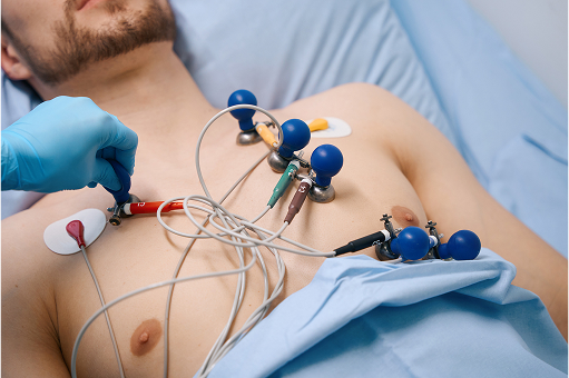 cardiograph-suction-cups-are-attached-to-a-young-p-2025-03-09-18-59-55-utc 1.jpg cardiograph-suction-cups-are-attached-to-a-young-p-2025-03-09-18-59-55-utc 1.jpg