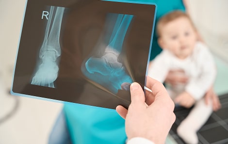 radiographer-examining-x-ray-of-infant-lower-extre-2024-10-19-23-29-39-utc 1-min.jpg radiographer-examining-x-ray-of-infant-lower-extre-2024-10-19-23-29-39-utc 1-min.jpg