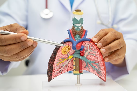 pneumonia-lung-cancer-asian-doctor-holding-human-2025-02-25-04-09-25-utc 1-min.jpg pneumonia-lung-cancer-asian-doctor-holding-human-2025-02-25-04-09-25-utc 1-min.jpg