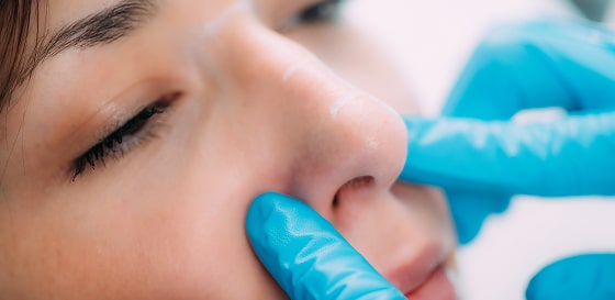 dermal-fillers-anti-aging-treatment-2024-10-22-06-18-46-utc 1-min.jpg dermal-fillers-anti-aging-treatment-2024-10-22-06-18-46-utc 1-min.jpg