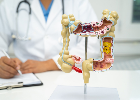 intestine-appendix-and-digestive-system-doctor-h-2025-02-24-12-36-14-utc 1.jpg intestine-appendix-and-digestive-system-doctor-h-2025-02-24-12-36-14-utc 1.jpg