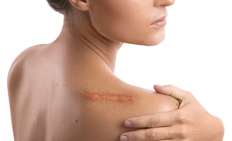 woman-with-a-scar-on-her-shoulder-2024-10-17-15-24-50-utc 1-min.jpg woman-with-a-scar-on-her-shoulder-2024-10-17-15-24-50-utc 1-min.jpg