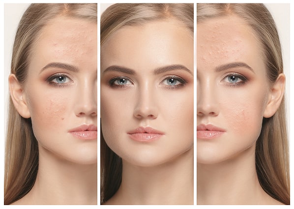 woman-before-and-after-treatment-2024-10-23-10-43-39-utc 1-min.jpg woman-before-and-after-treatment-2024-10-23-10-43-39-utc 1-min.jpg