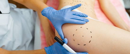 cosmetician-with-marker-puts-dotted-lines-on-body-2024-11-28-12-12-39-utc 1-min.jpg cosmetician-with-marker-puts-dotted-lines-on-body-2024-11-28-12-12-39-utc 1-min.jpg