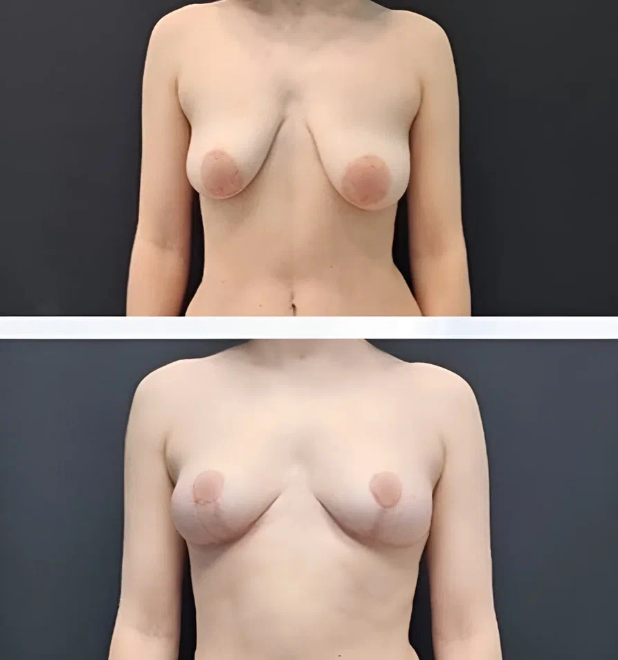 hd_efd5a2c2be3ccbbc36e8ef20e57c26b5_67d270f61ab1a.jpg hd_efd5a2c2be3ccbbc36e8ef20e57c26b5_67d270f61ab1a.jpg