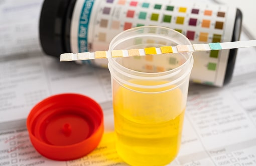 urinalysis-urine-cup-with-reagent-strip-ph-paper-2025-02-25-04-42-59-utc (1)-min.jpg urinalysis-urine-cup-with-reagent-strip-ph-paper-2025-02-25-04-42-59-utc (1)-min.jpg